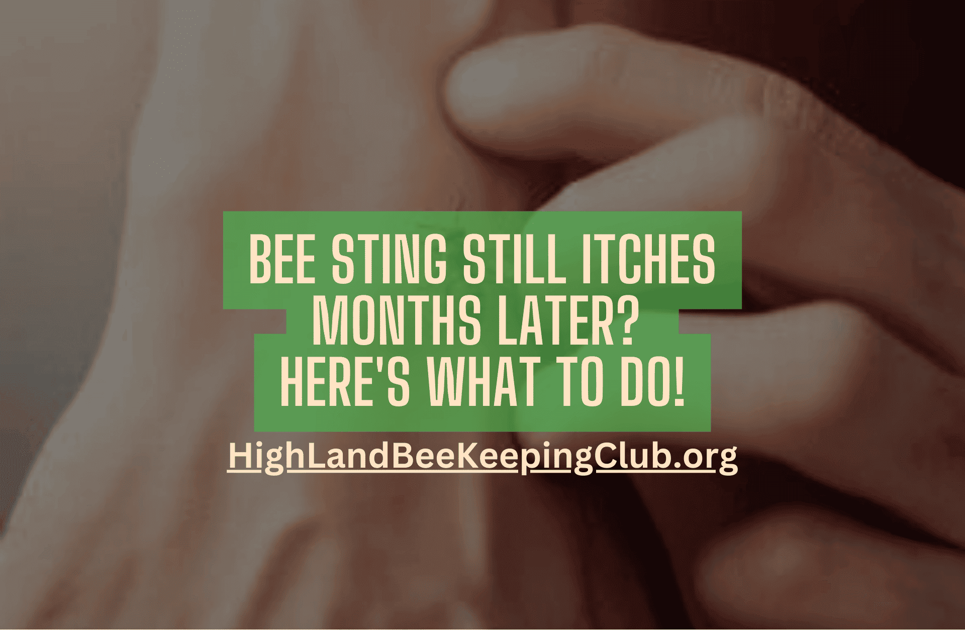 bee-sting-still-itches-months-later-here-s-what-to-do